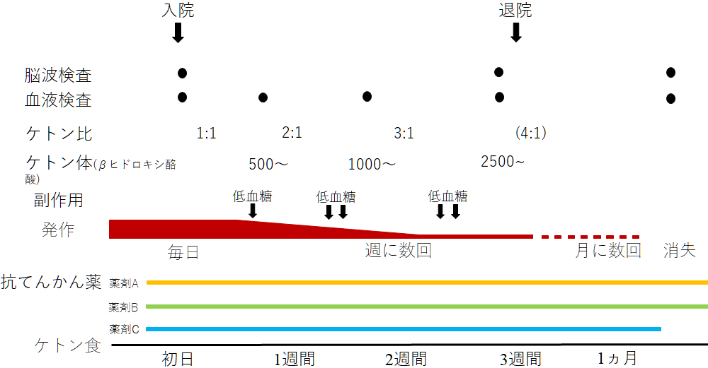 てんかんの内科的治療 大阪大学医学部附属病院てんかんセンター