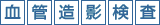 血管造影検査