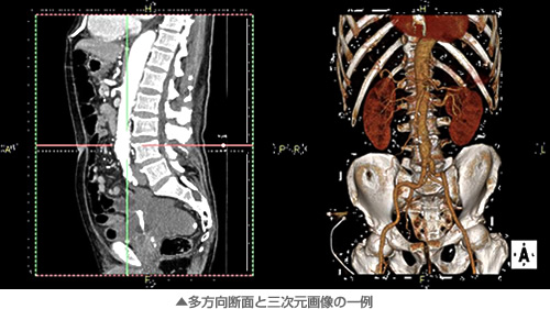 多方向断面と三次元画像の一例