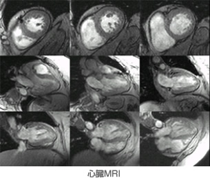 心臓MRI