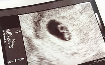 胎児疾患の詳しい検査